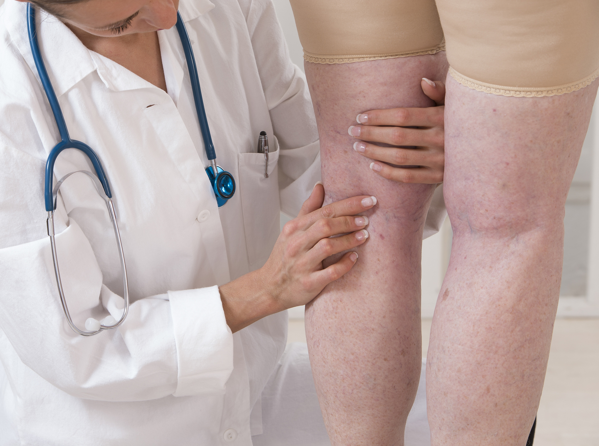 urubul genunchiului varicosera tratament eczema varicoza picioare